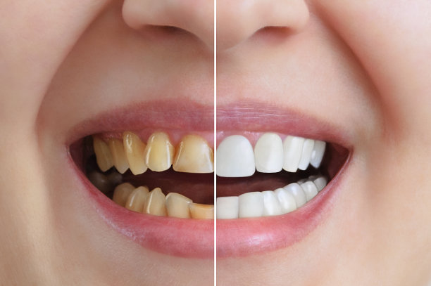 teeth