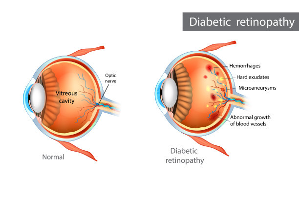 retina