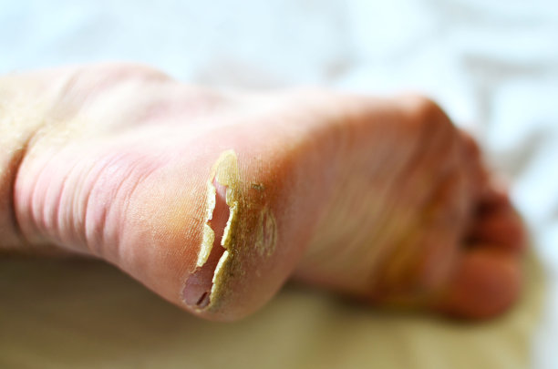 feet