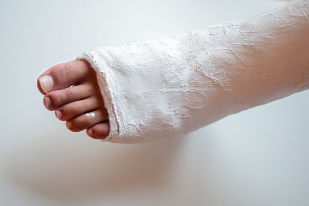 cast