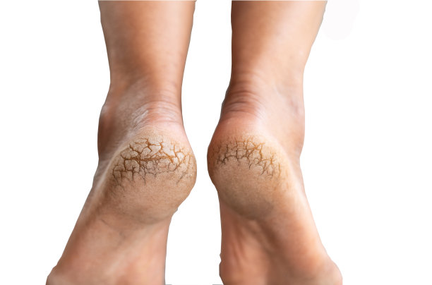 foot
