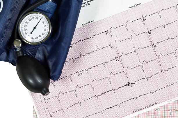 ekg