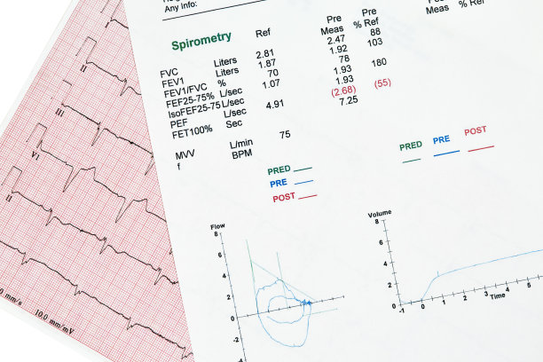 ekg