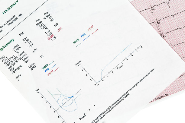 ekg