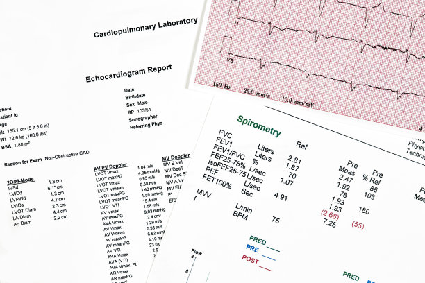 ecg
