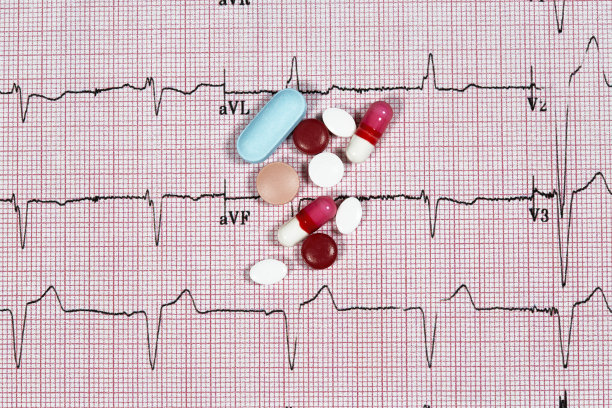 ekg