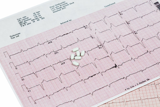 ekg