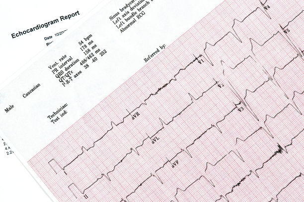 ekg