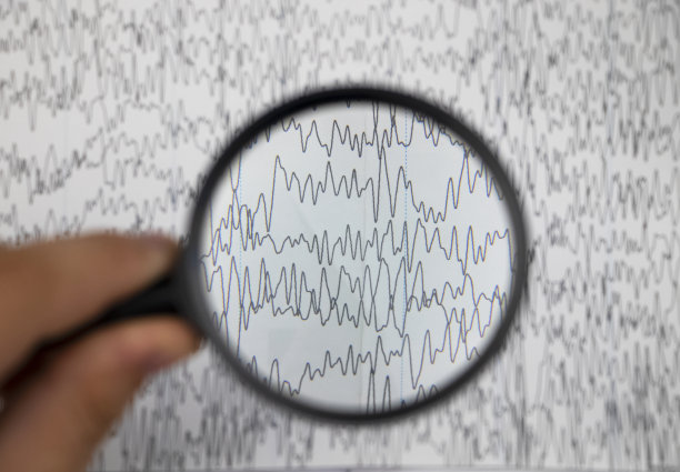 eeg