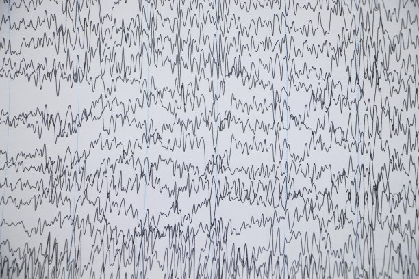 eeg