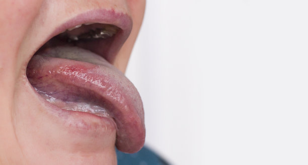 mouth
