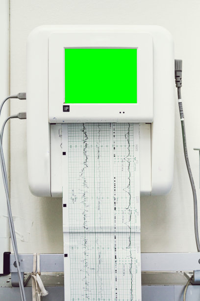 ekg