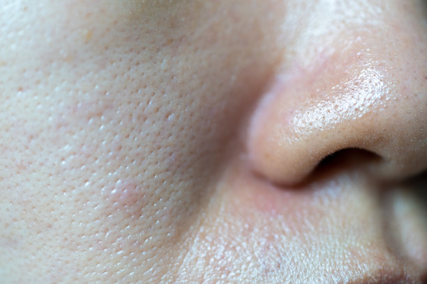 pores