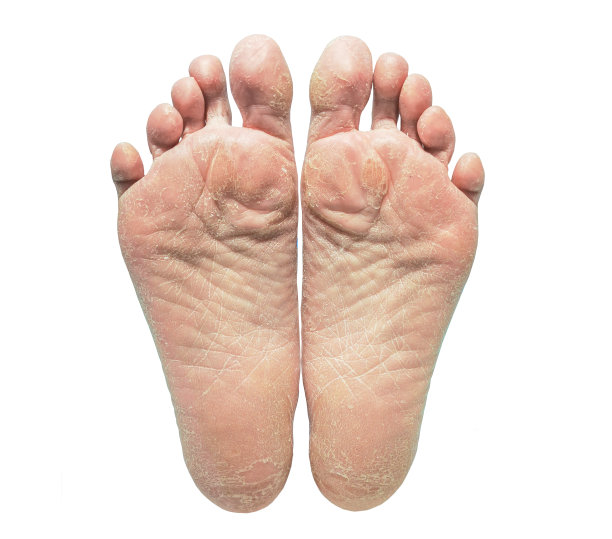 feet