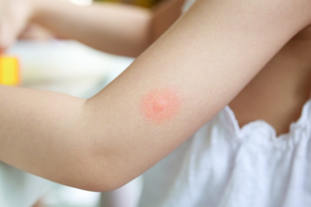 mosquito