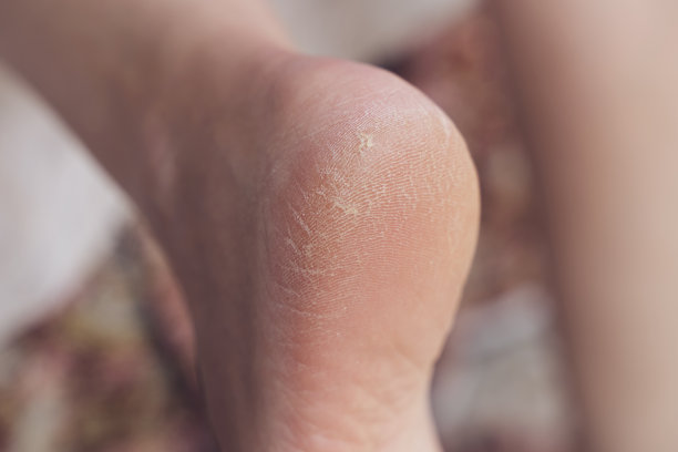 feet