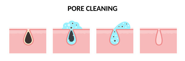 pores