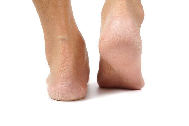 feet