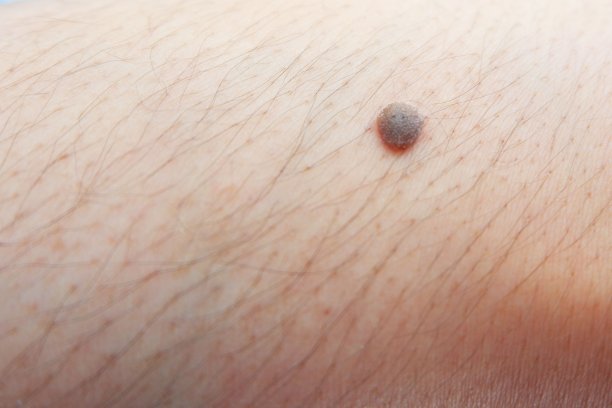 mole