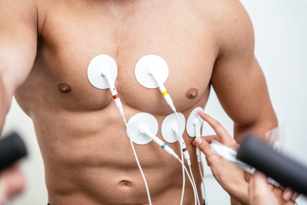 ecg