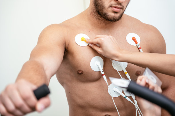 ecg