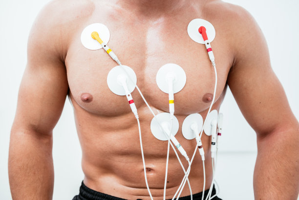 ecg