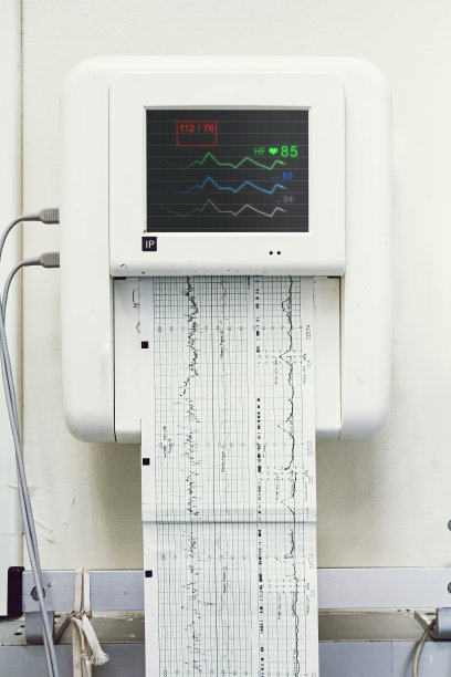 ekg