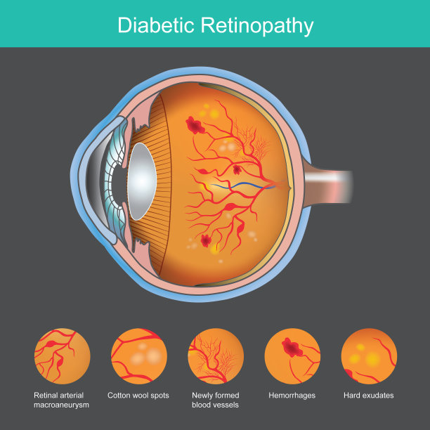 retina