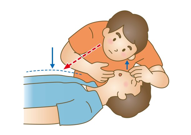 cpr