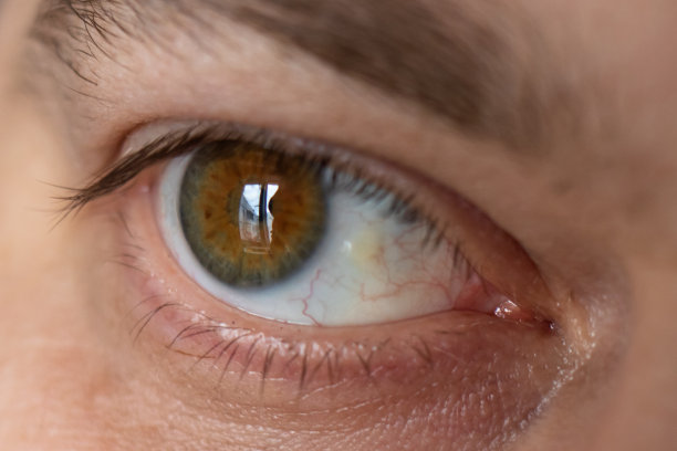 retina