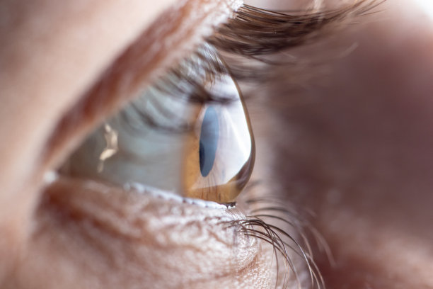 retina