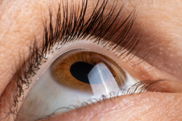 retina