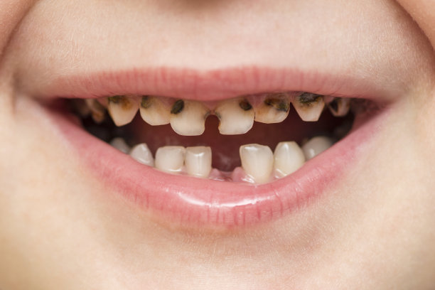 teeth