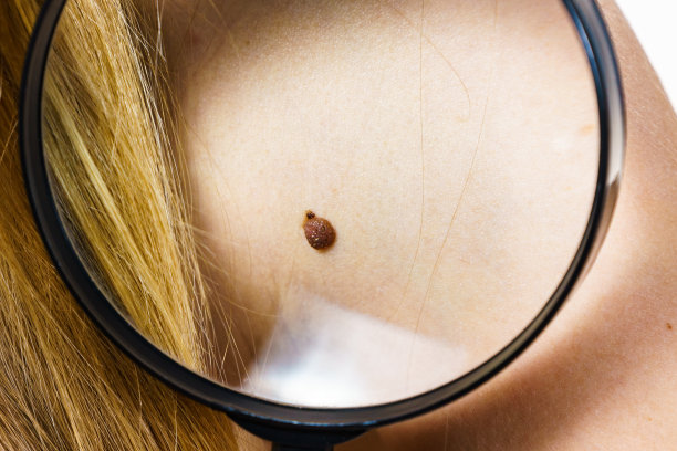 mole