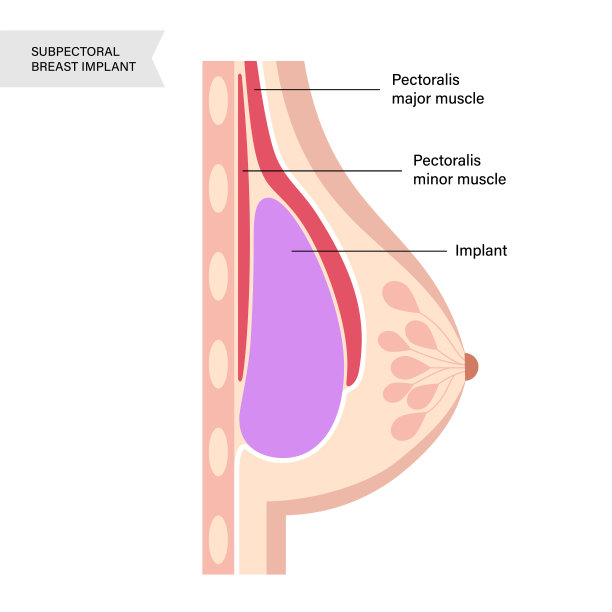 breast