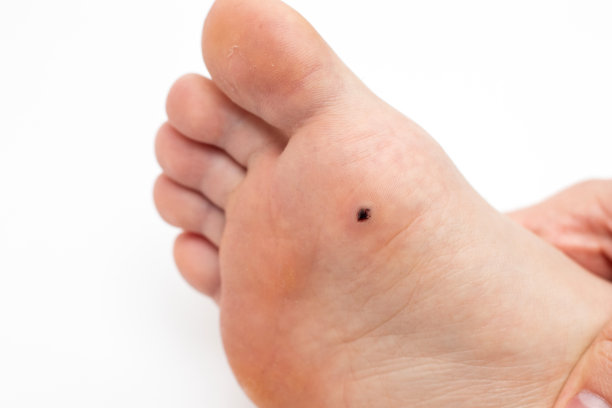 mole