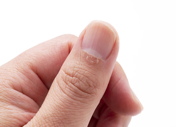 fingers