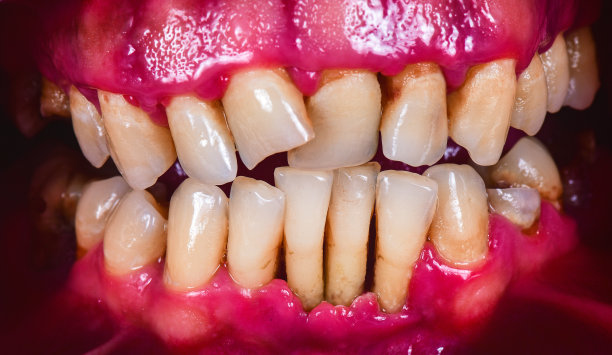 teeth
