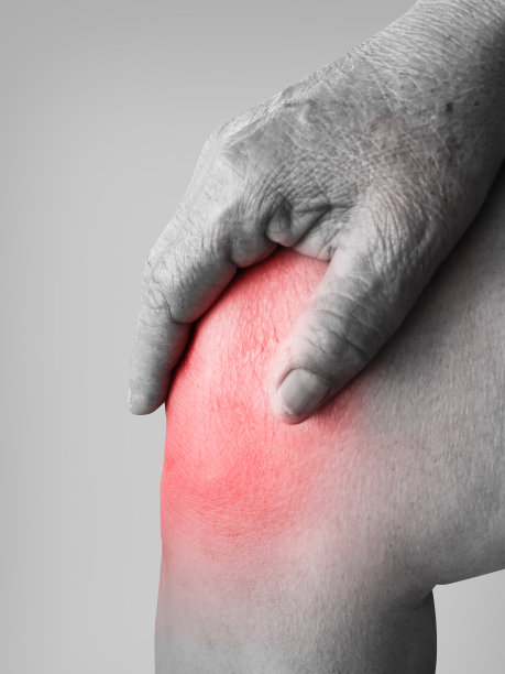 arthritis