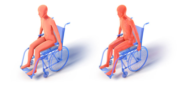 disabled