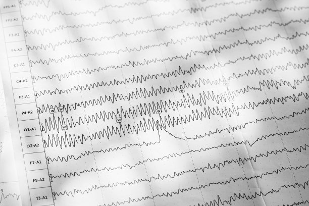 eeg