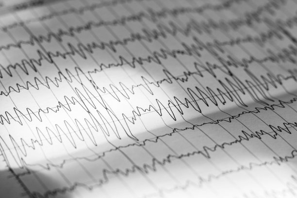 eeg