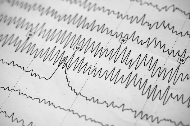 eeg