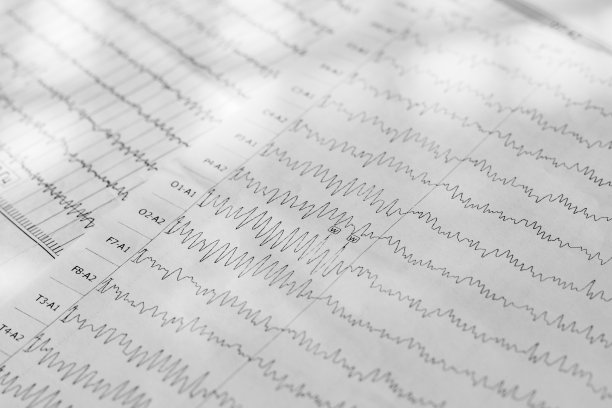 eeg