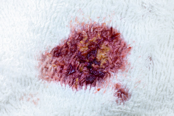 stained