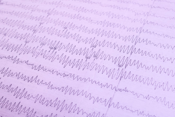 eeg