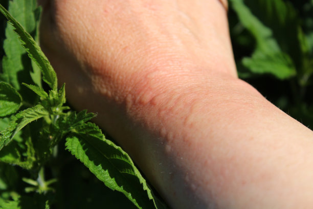 nettles