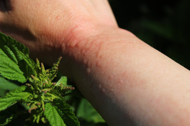 nettles