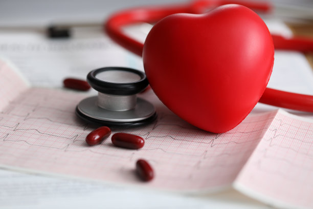 ekg