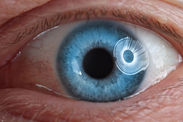 retina